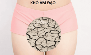 Khô Âm Đạo (vùng kín): Nguyên Nhân, Triệu Chứng Và Cách Chuẩn Đoán