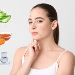 Cách Điều Trị Mụn Ở Quai Hàm Dễ Dàng, Thực Hiện Hiệu Quả Sau 1 Tuần